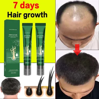 Óleo de crescimento face cabelo rápido crescimento face cabelo un fel eficaz calvície reparação hereditária perda de cabelo pós-parto perda Imagine